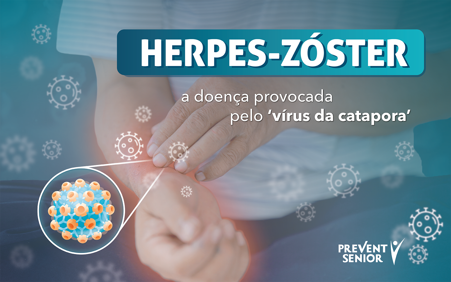 Herpes-zóster, por que o Adulto+ deve ficar atento aos sintomas e se vacinar